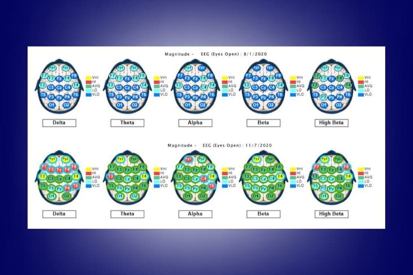 When Nothing’s Working… Here’s What a Brain Map Can Show You That Nothing Else Will | E309