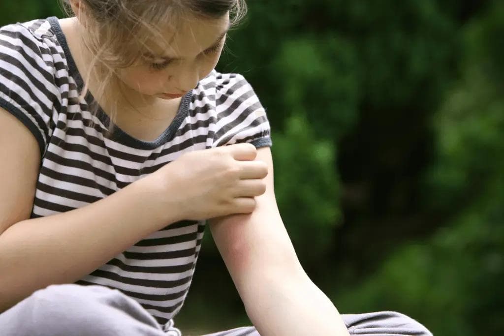 Cognitive and Psychiatric Impact of Lyme Disease